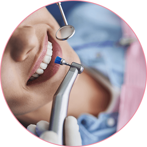 歯のクリーニング