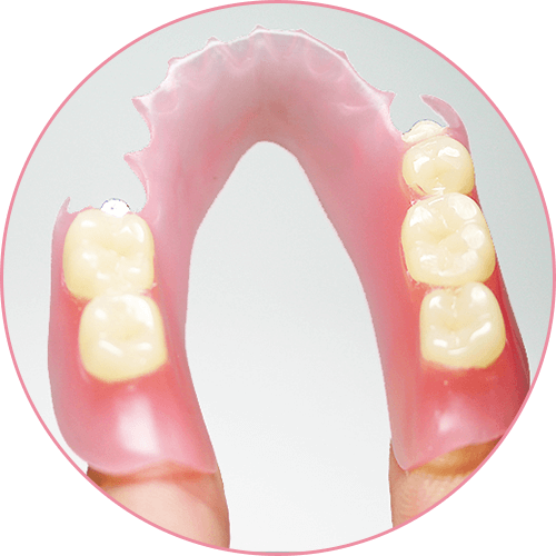 魔法の入れ歯「カルデント」